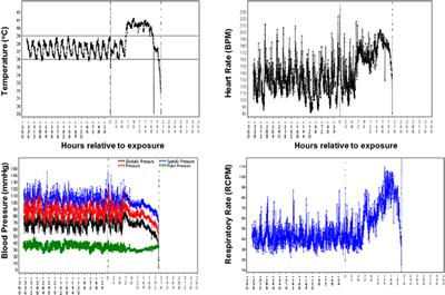 The Cynomolgus Macaque Natural History Model of Pneumonic Tularemia for Predicting Clinical Efficacy Under the Animal Rule